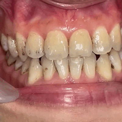 Công dụng - ảnh 1